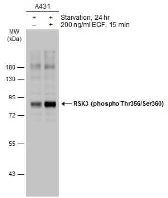 Western Blot: RSK3 [p Ser360, p Thr356] Antibody [NBP3-13272]